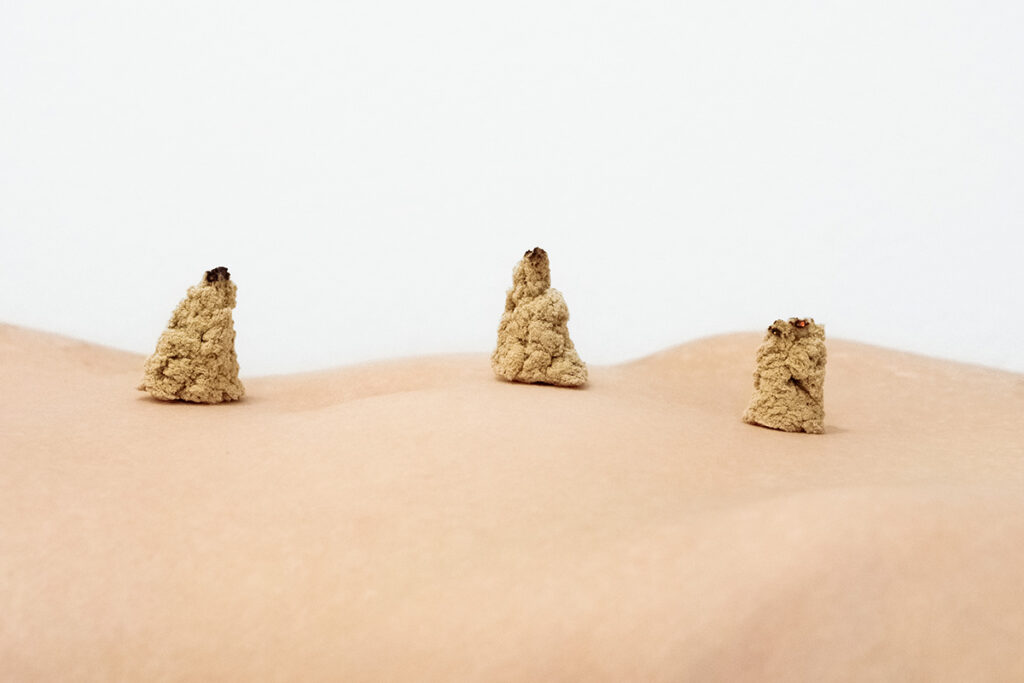 acupuncture london traditional chinese medicine