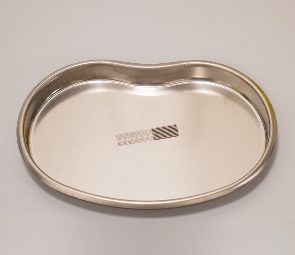 acupuncture london traditional chinese medicine